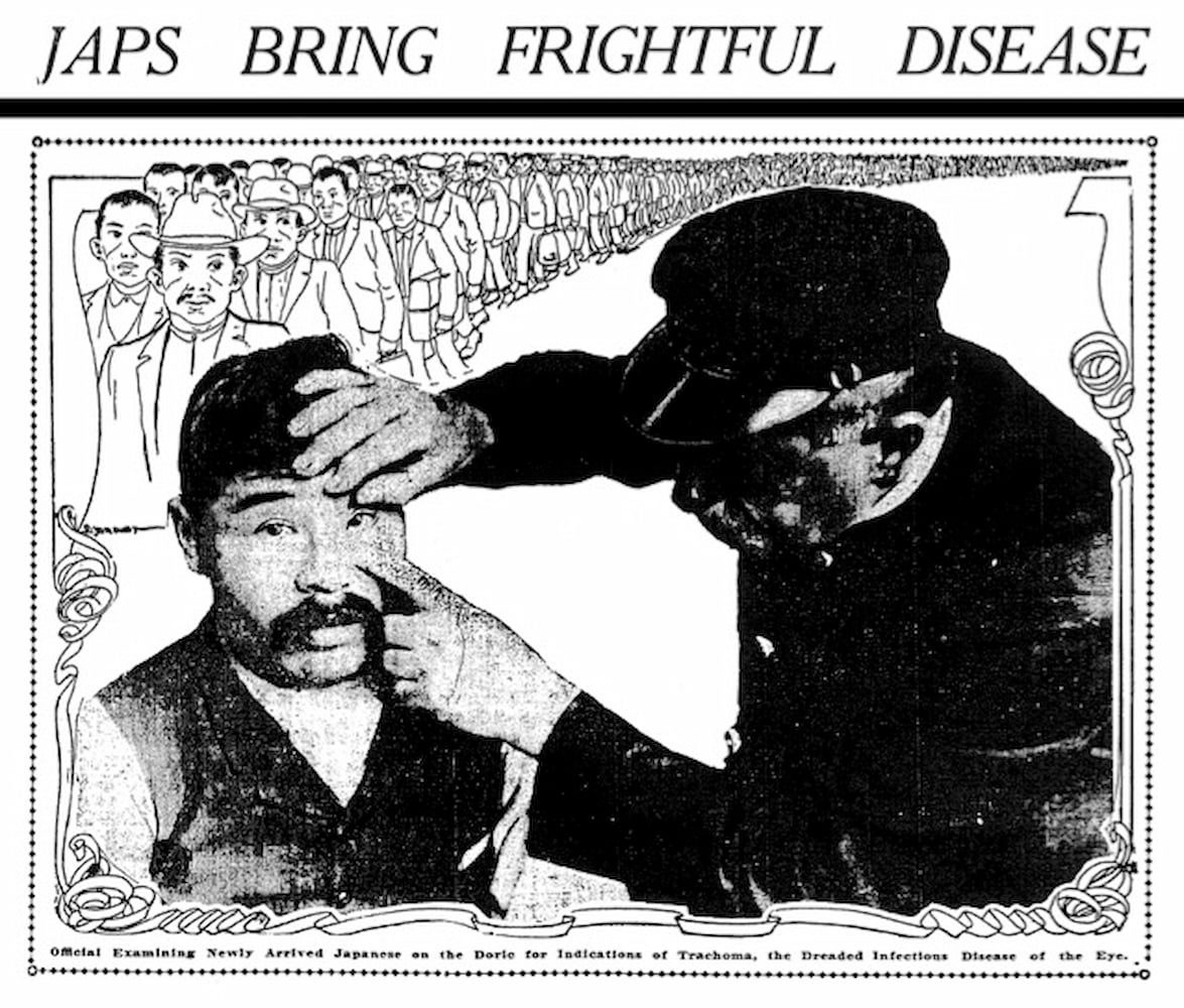 Drawing that reads "Japs Bring Frightful Disease" shows an examiner inspecting male subject. A line of Japanese are seen in the background.